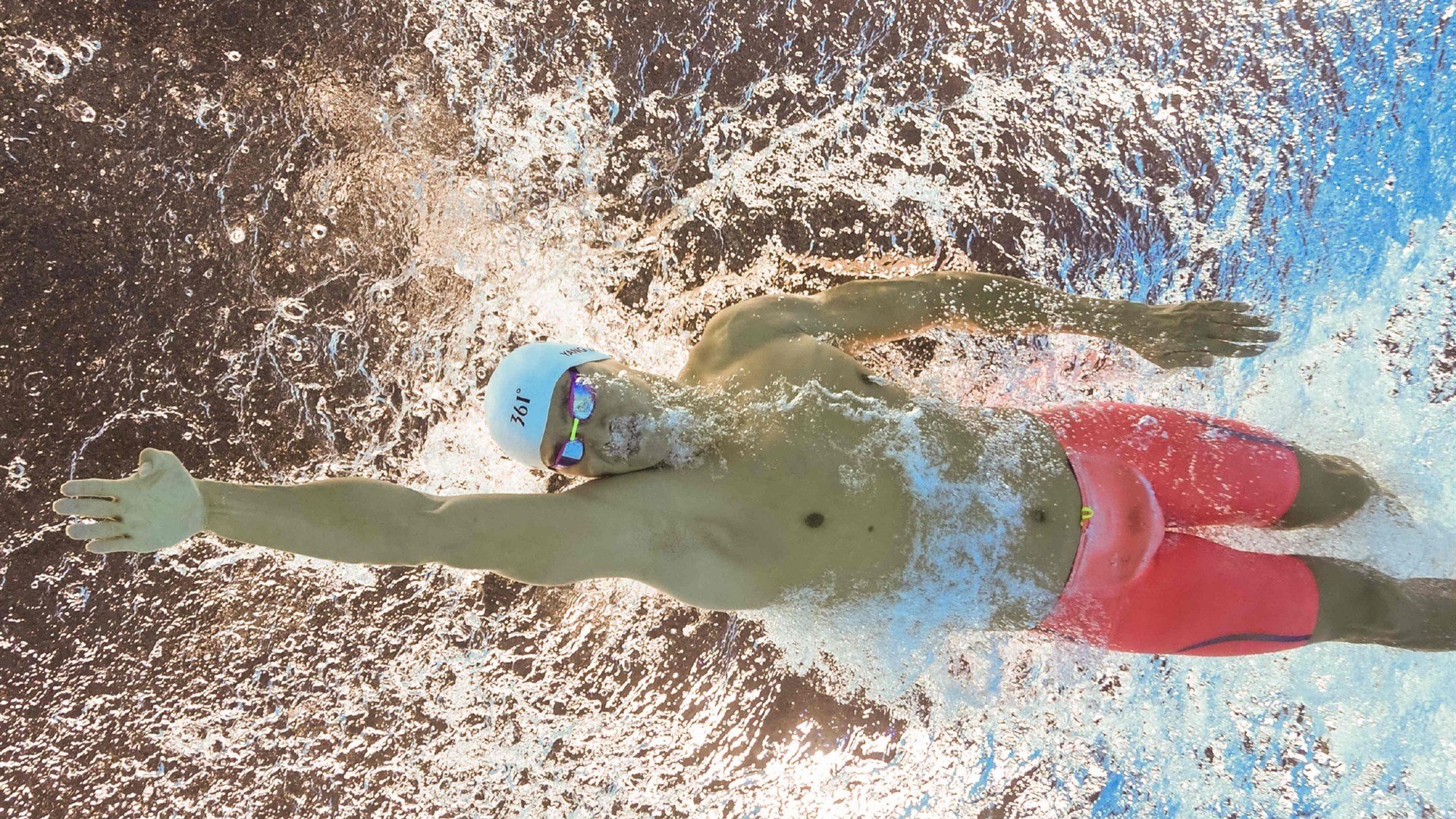 朱婷接受媒体专访谈伤后恢复过程，朱婷伤有多严重